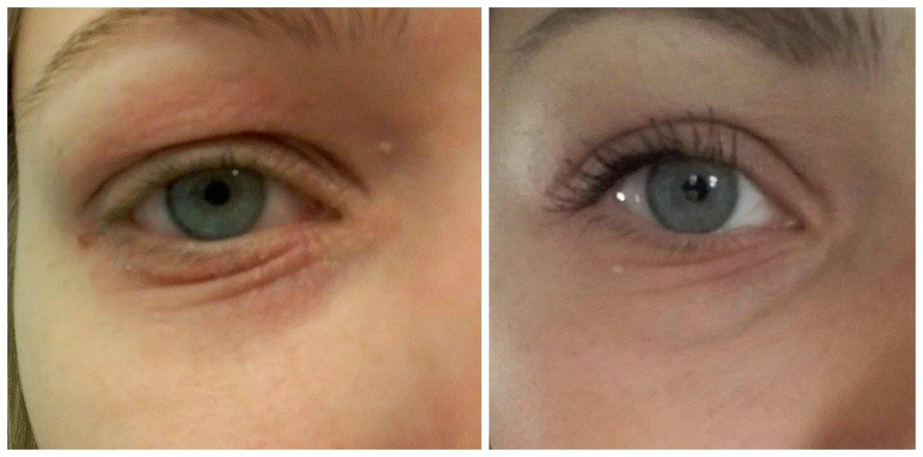 bioderma-elotte-utana